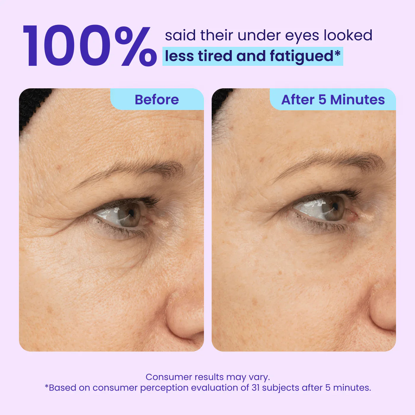 ✨New Arrivals✨ Genvelle® Instant Lift Eye Gel