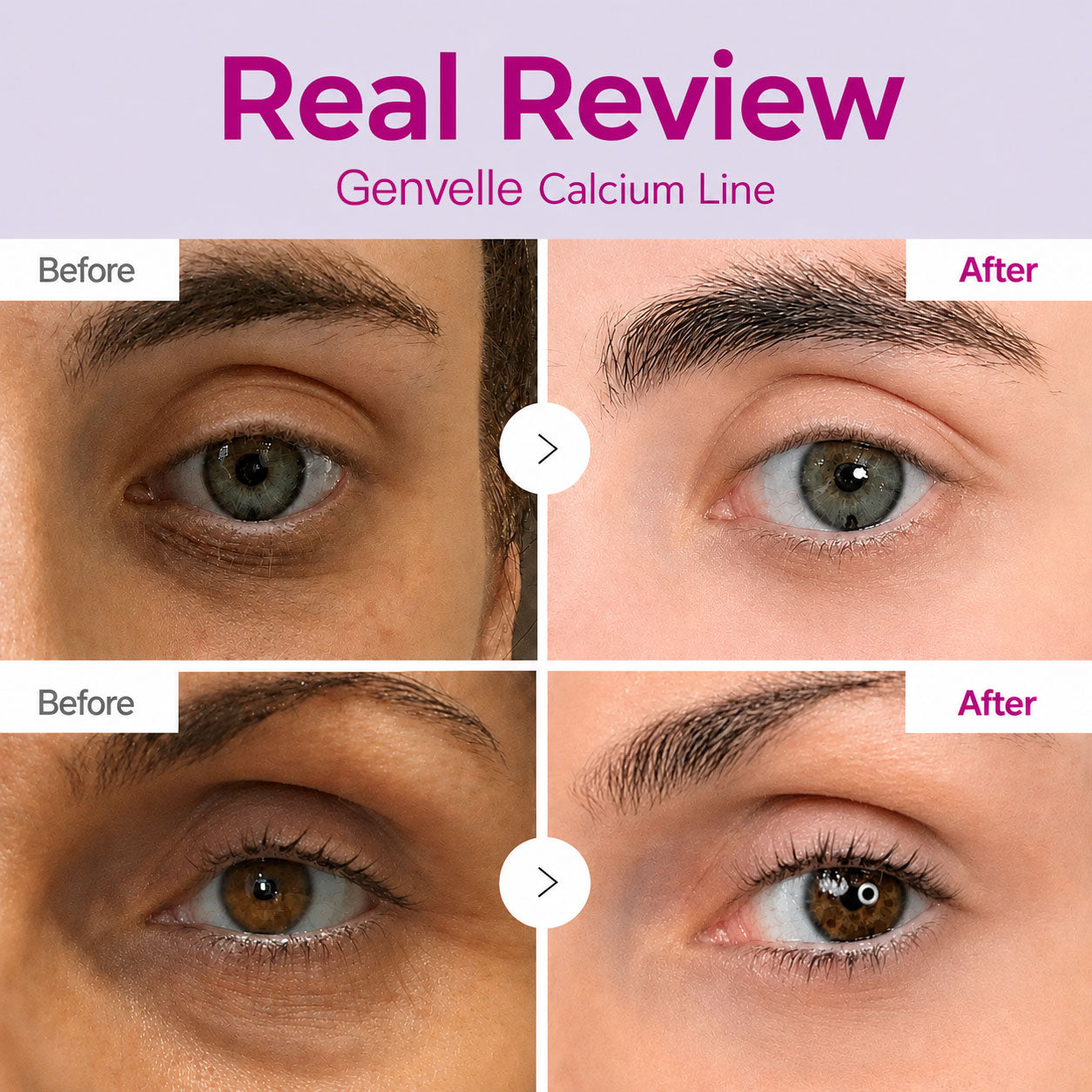 🔥LAST DAY 50% OFF!! Genvelle Korean Calcium Dark Spot Eye Cream