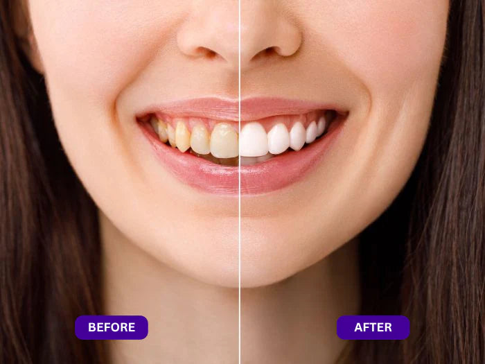 Genvelle™ Purple Mouth Wash