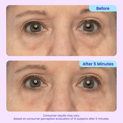 ✨New Arrivals✨ Genvelle® Instant Lift Eye Gel