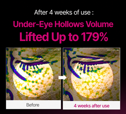 🔥LAST DAY 50% OFF!! Genvelle Korean Calcium Dark Spot Eye Cream